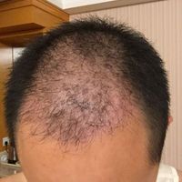 發(fā)際線用戶圖片