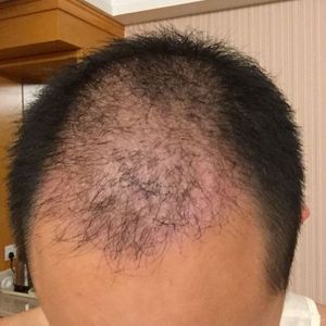 发际线分享社区