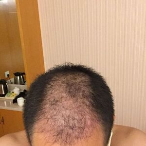 发际线分享社区
