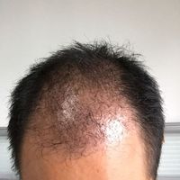 發(fā)際線用戶圖片