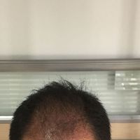 發(fā)際線用戶圖片