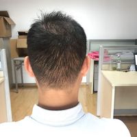 發(fā)際線用戶圖片