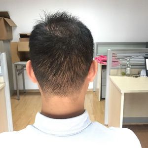 发际线分享社区