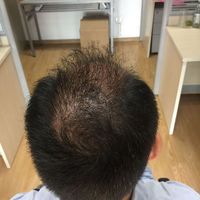 發(fā)際線用戶圖片