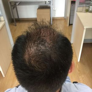 发际线分享社区