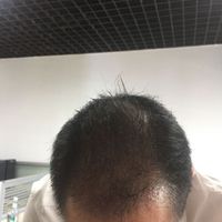發(fā)際線用戶圖片