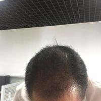 發(fā)際線用戶圖片