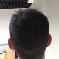 發(fā)際線用戶圖片
