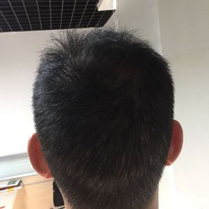 发际线分享社区