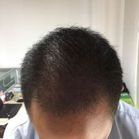 發(fā)際線用戶圖片
