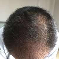 發(fā)際線用戶圖片