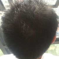 發(fā)際線用戶圖片