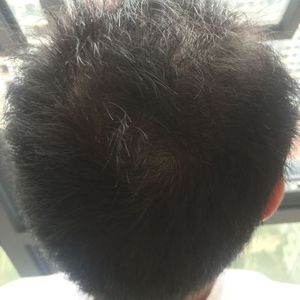 发际线分享社区