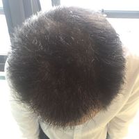 發(fā)際線用戶圖片