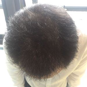 发际线分享社区