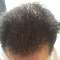 發(fā)際線用戶圖片