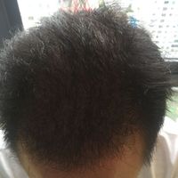發(fā)際線用戶圖片