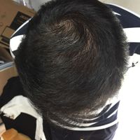 發(fā)際線用戶圖片