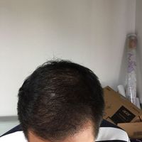發(fā)際線用戶圖片