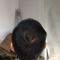 發(fā)際線用戶圖片