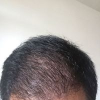發(fā)際線用戶圖片