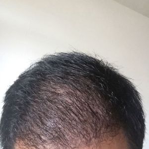 发际线分享社区