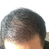 發(fā)際線用戶圖片