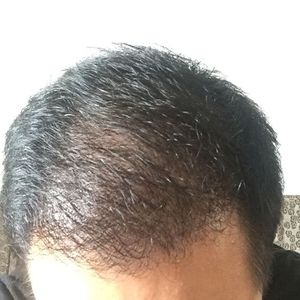 发际线分享社区