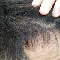 發(fā)際線用戶圖片