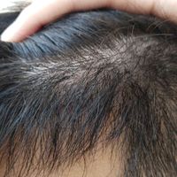 發(fā)際線用戶圖片