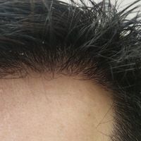 發(fā)際線用戶圖片