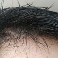 發(fā)際線用戶圖片