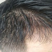 發(fā)際線用戶圖片