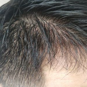 发际线分享社区