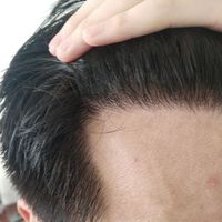 發(fā)際線用戶圖片