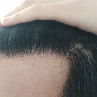 發(fā)際線用戶圖片