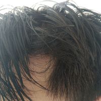 發(fā)際線用戶圖片