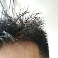 發(fā)際線用戶圖片