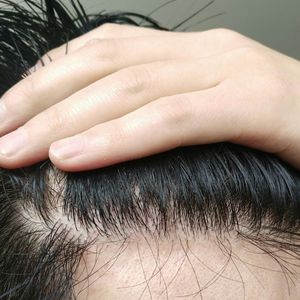发际线分享社区