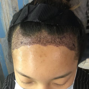 发际线分享社区