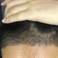 發(fā)際線用戶圖片