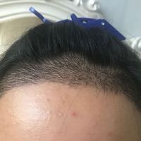 發(fā)際線用戶圖片