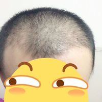 發(fā)際線用戶圖片