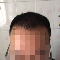 發(fā)際線用戶圖片