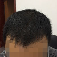 發(fā)際線用戶圖片