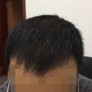 发际线分享社区