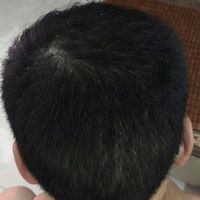 發(fā)際線用戶圖片