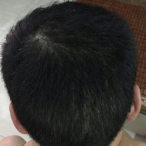 发际线分享社区