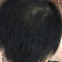 發(fā)際線用戶圖片