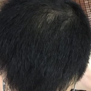 发际线分享社区